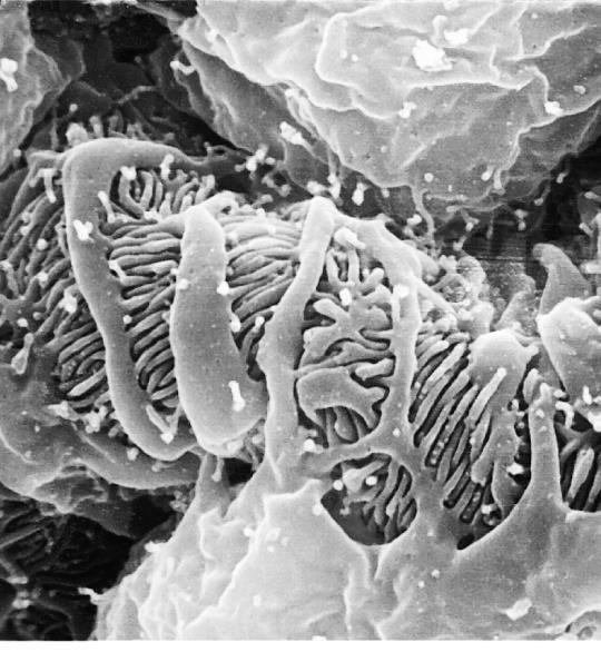 A filtração de solutos é determinada pelo seu tamanho e carga elétrica: À medida que o peso molecular dos solutos aumenta,