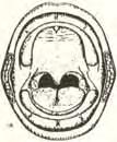 Identificação da neoplasia