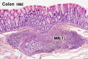 mucosa-associated MALT