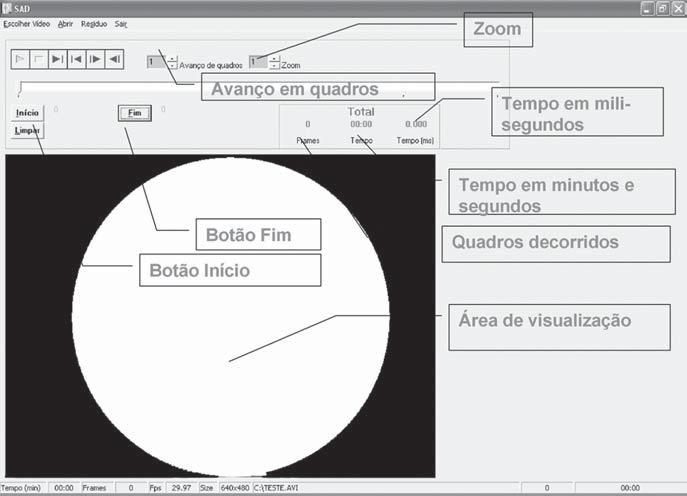 Software para análise quantitativa da deglutição (arquivo no formato de um filme), para execução dos cálculos de tempo.