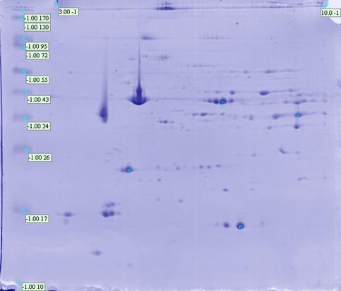 Avaliação da expressão protéica Análise do mapa In silico : Os géis 2-DE são analisados com o auxílio