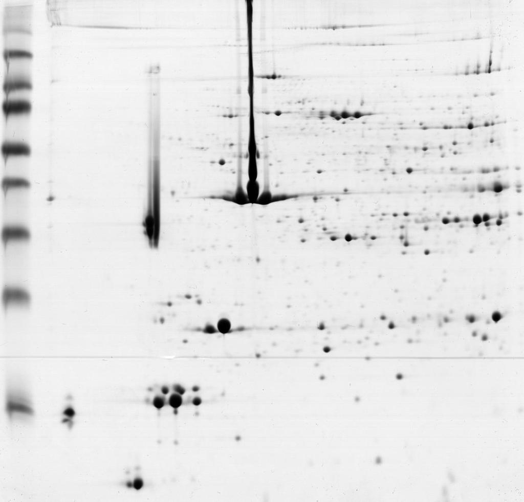 Spots diferencialmente expressos ph 4 7 176: Complex III subunit 1 236: HSP70-1 150: Alpha-actin-1 327: Beta-LG 122: Alpha-actin-1 241 1: Acyl-CoA binding domain
