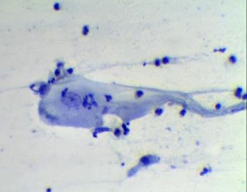 Padilha, CML, et. al.