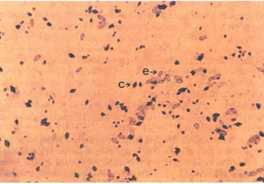 224 J.O. SILVA-WERNECK et al. FIG. 1. Esporos (e) e cristais bipiramidais (c) do isolado S93 de Bacillus thuringiensis subsp. kurstaki, após coloração por amido black, sob aumento de 1000 X. TABELA 1.