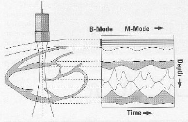 IMAGEM MÉDICA EQUIPAMENTO (ECÓGRAFO) MODO M USADO EM CARDIOLOGIA Eixo X