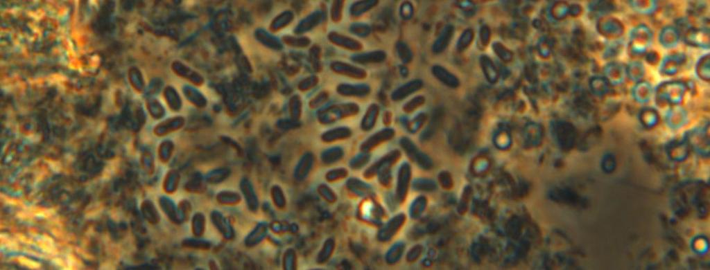 e de filamentos. Além disso, os resultados da microscopia de contraste de fase e fluorescência da biomassa do AnSBR também foram iguais aos do AnSBBR.