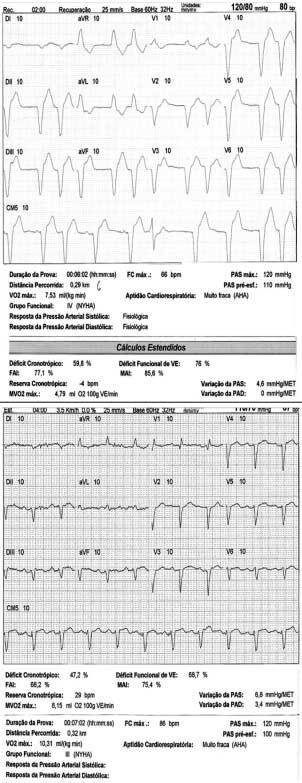 diâmetros e o volume ventriculares, minimizar a insuficiência valvar mitral e promover o sincronismo da contração inter e intraventricular,