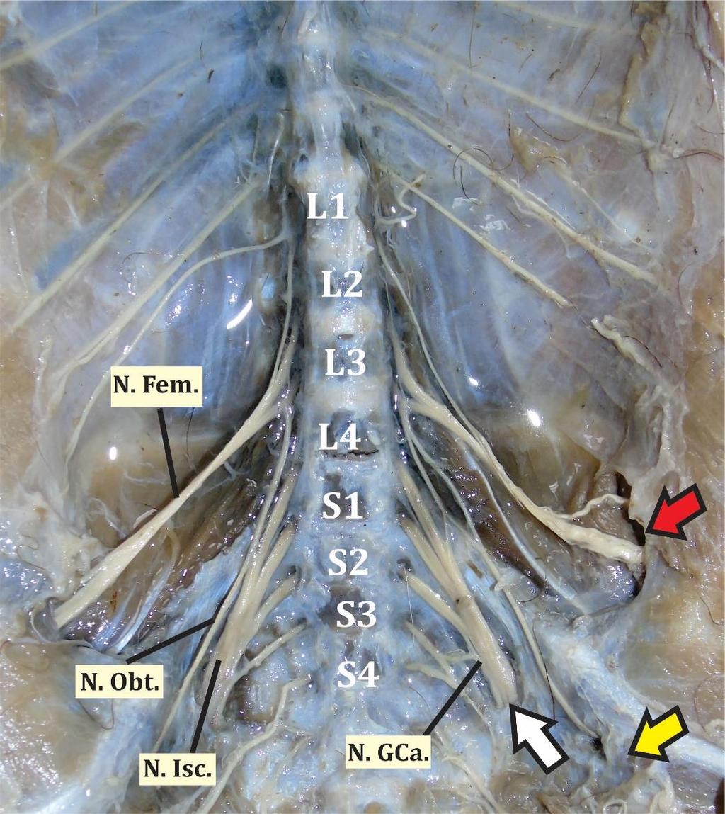 Figura 1. Origem de nervos componentes do plexo lombossacral no bicho-preguiça-degarganta-marrom (Bradypus variegatus). N. Fem - nervo femoral; N. Obt nervo obturatório; N. Isc. nervo isquiático; N.