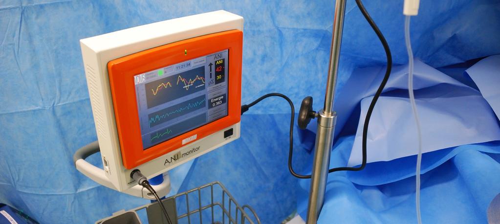 O PRIMEIRO sistema de monitorização CONTÍNUA e NÃO INVASIVA do tónus parassimpático Os mecanismos fisiológicos associados à nocicepção e à sua supressão situam-se a diferentes níveis subcorticais.