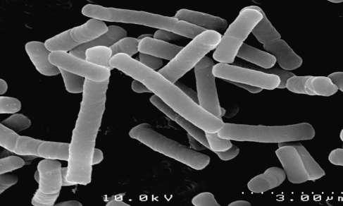 Lactobacillus Necessita sítios retentivos para iniciar a desmineralização; Proporção em superfícies intactas do esmalte é de 0,01% da