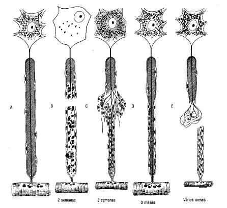 Regeneração Neural Periférica Proliferação das células de Schwann Cilindro de