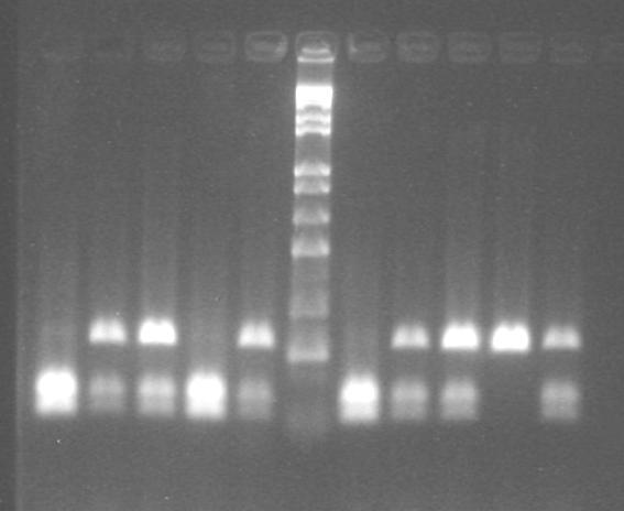 PCR 5 PCR CLIVAGEM 11 ENZIMÁTICA Marc 1 2 3 4 5 1Kb 6 7 8 9 10 GENÓTIPOS