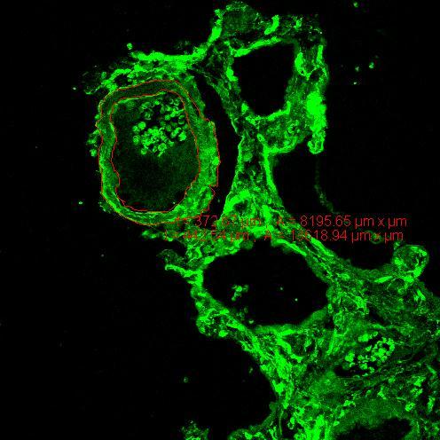 Figura 2. Foto da artéria do grupo ES vista através do microscópio confocal a laser.