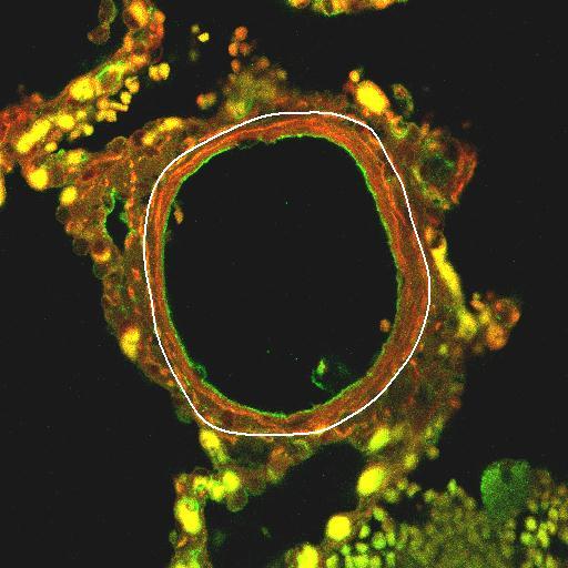 34 Figura 3. Fotos da artéria do grupo controle vista através do microscópio confocal a laser.
