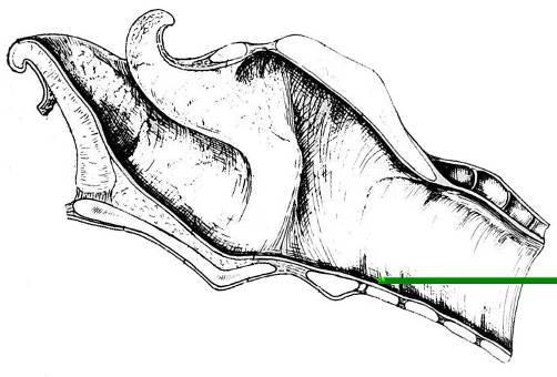 VISTA MEDIAL DA SECÇÃO MEDIANA DA LARINGE DO