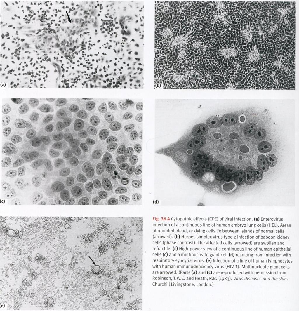 Efeito citopático http://www.virology.