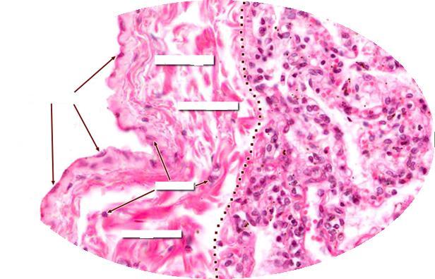 Qual a histologia das