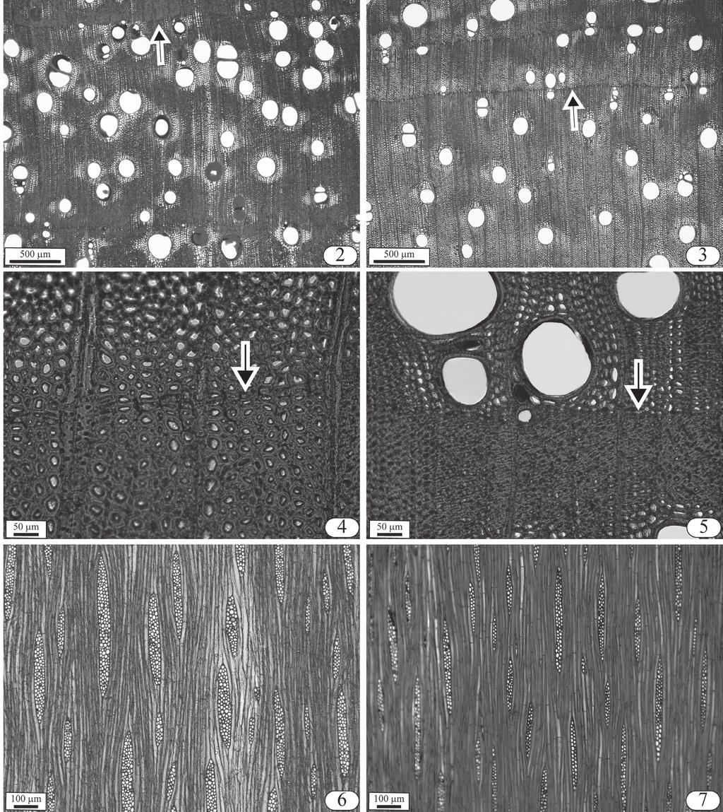 E.L. Longui et al.: Anatomia do lenho de Piptadenia gonoacantha 719 Figuras 2-5. Secções transversais. 2. Marcação da camada de crescimento (seta). 3.