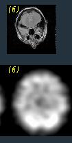 Resumo: Conceitos básicos Imagem digital > matriz n-dimensional D > piel picture element raio X - CR 496 496 B short f[496][496] 3D > voel volume