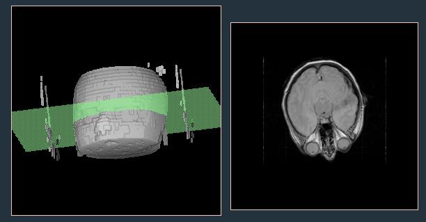 de imagens 3D Estudo multi-modal modal CT, MRI, SPECT,.