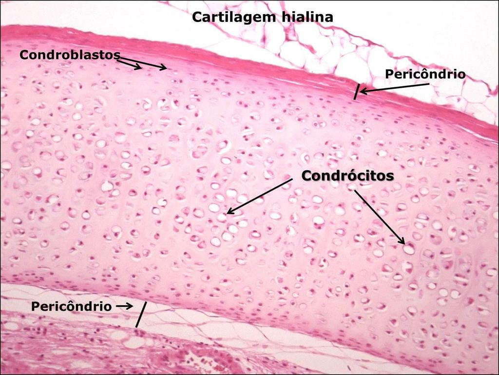 CARTILAGEM HIALINA A cartilagem hialina é a variedade mais encontrada no corpo humano e, portanto, a mais estudada.