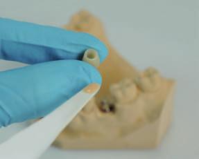 Passo 2 Ligação Aplique cimento dentário autoadesivo ² no pilar Variobase. Siga as instruções do fabricante do cimento.
