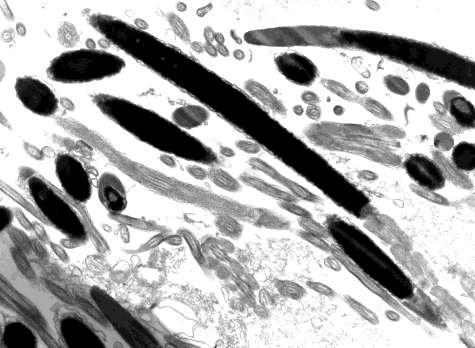 36 Figura 2: Eletro micrografia de espermatozoide de peru em corte longitudinal onde se observa