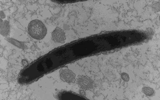 µm). Figura 3: Eletromicrografia de espermatozoide de peru em corte longitudinal onde se observa