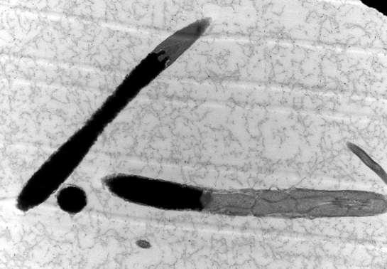 37 Figura 4: Eletromicrografia de espermatozoide de peru em corte longitudinal onde se observa compactação cromatínica normal. (Barra 2 µm).