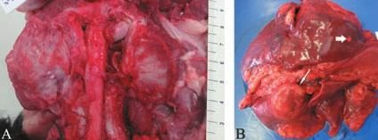 The pleural cavity contained around 100 ml of hemorrhagic fluid and both lungs exhibited various nodules, ranging from 0.5 to 4 cm in diameter (Figure 4B).