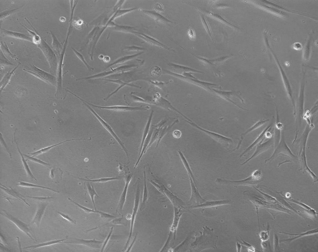 Métodos 28 Figura 6- Característica morfológica de fibroblastos das células-tronco mesenquimais humanas vistos ao microscópio com aumento de 100x Em seguida, as células foram incubadas com os