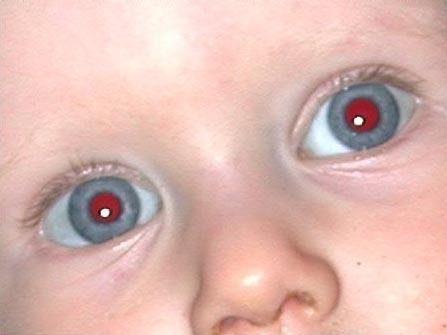 Você já se perguntou qual o motivo de, às vezes, aparecermos com os olhos vermelhos nas fotos?