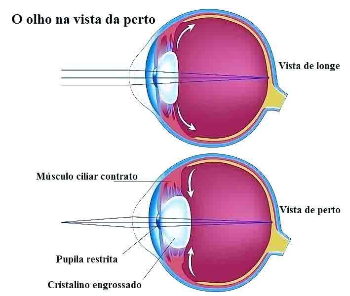 Para que as imagens conjugadas pelo sistema óptico do globo ocular sejam nítidas, elas devem formar-se sobre a retina, cuja distância da