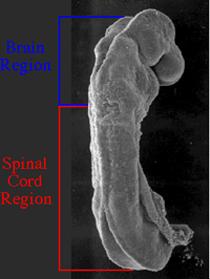 Fim do fechamento do Tubo Neural: - Parte caudal = medula (estreita) - Parte cefálica =