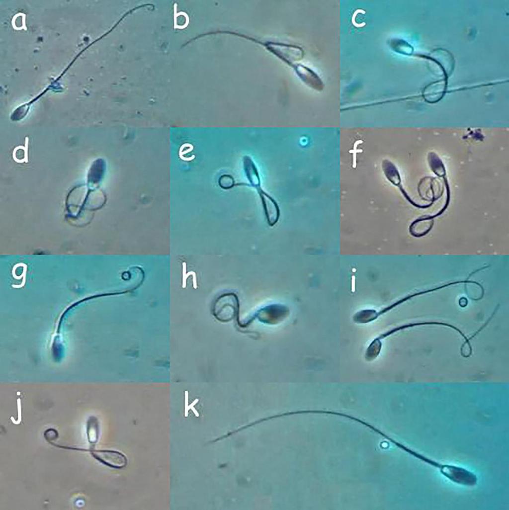 14 Figura 1. Espermatozoides equinos criopreservados submetidos ao HOST após a descongelação.