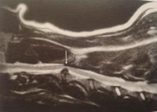 48 em medicina humana mostraram que as fraturas da coluna vertebral podem ser ignoradas nas imagens de RM. É importante ter cuidado com as configurações de MRI.