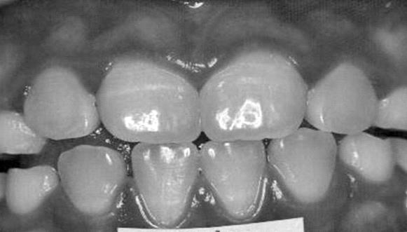 Queiroga et al., / Revista Uigá V.5,.,pp.9-7 (Jul - Set 7) caso (FURTADO et al., RIGO et al., 5).