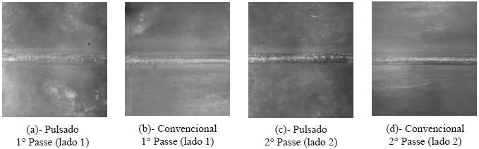 A contagem dos pontos foi feita nos encontros de cada quadrado de uma malha quadriculada, com quadros de 10x10mm, colocada em cima das micrografias impressas.