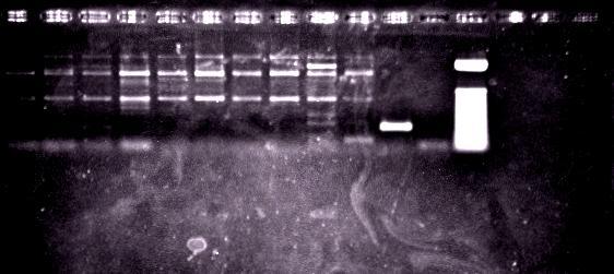 73 1 2 3 4 5 6 7 8 9 10 11 12 13 14 15 16 Figura 10: Amplificações para alvo ITS1 de Toxoplasma gondii em cérebros das galinhas domésticas do estudo.