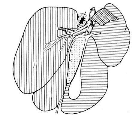 quadrado Vesícula Biliar Lobo Hepático Medial direito Suíno Lobo Quadrado Lobo Caudado (processo caudado) Lobo