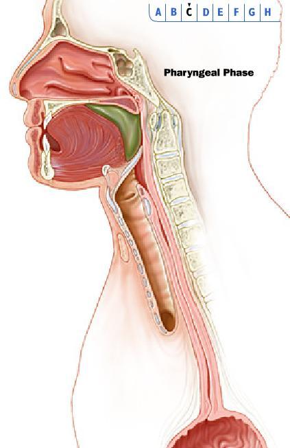 Fase faríngea: fechamento das pregas vocais, da epiglote, levantamento da farínge e abertura do esfíncter esofágico