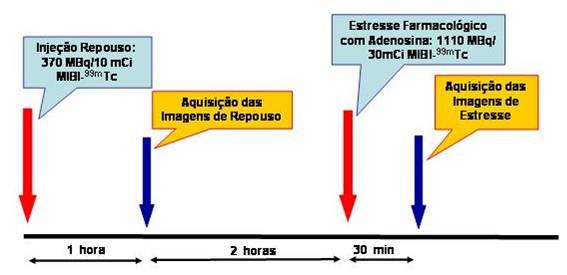 26 angulados a 90 e equipados com colimadores de alta resolução e para baixa energia com janela de 15% centrada em pico de energia de 140 kev.