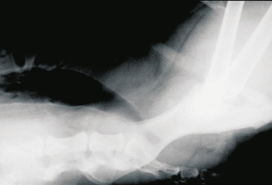 quando comparada à ultra-sonografia. Radiografias abdominais podem ser limitadas para caracterizar doenças prostáticas.