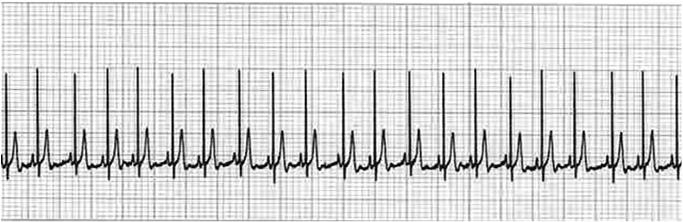 2ª. parte Medida da Frequência Cardíaca