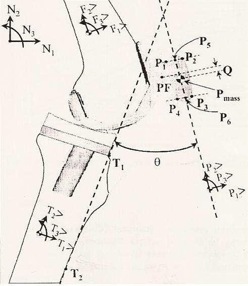 O tilt patelar pode ser definido como uma rotação que ocorre sobre um eixo axial flutuante passando da borda medial à borda lateral da patela (KATCHBURIAN et al., 2003; MCCONNELL, 1994).