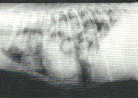 22 biológico do tumor como também na conduta terapêutica (DE NARDI et al., 2010). A excisão cirúrgica permite o exame histopatológico do tumor para diferenciação (QUEIROGA e LOPES, 2002).