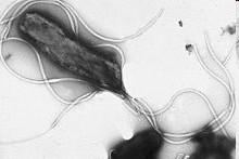 Helicobacter pylori é uma espécie de bactéria que