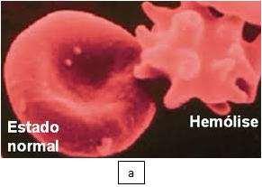 (valor diagnóstico limitado) Anticoagulante Oxalato, citrato e EDTA Oxalato Citrato e Oxalato Heparina Enzimas inibidas Amilase Transaminases Gama GT Lactato desidrogenase Deve ser