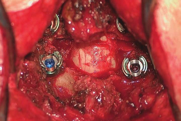 , colposcopia, conização CIRURGIA DA MÃO e CIRURGIA PLÁSTICA, por ex.