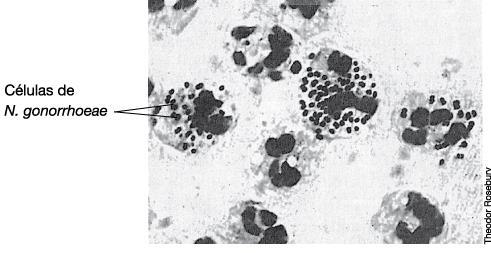 Neisseria gonorrhoeae em leucócitos humanos presentes em secreção